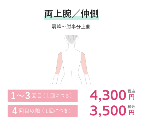 両上腕／伸側 1~3回目(1回につき)4,300円税込 4回目以降(1回につき)3,500円税込