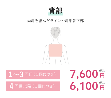 背部 1~3回目(1回につき)7,600円税込 4回目以降(1回につき)6,100円税込