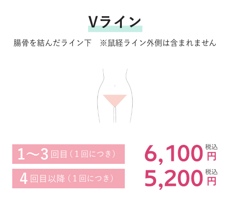 Vライン 1~3回目(1回につき)6,100円税込 4回目以降(1回につき)5,200円税込