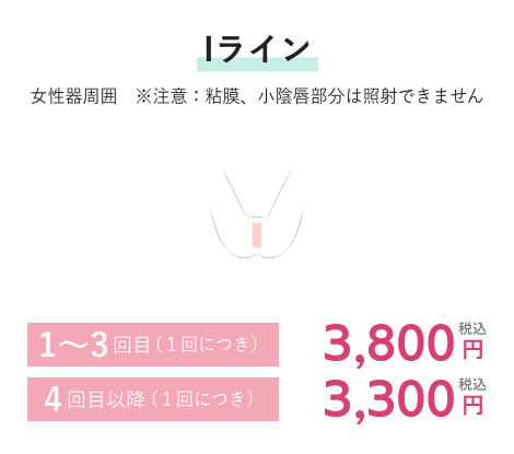 Iライン 1~3回目(1回につき)3,800円税込 4回目以降(1回につき)3,300円税込