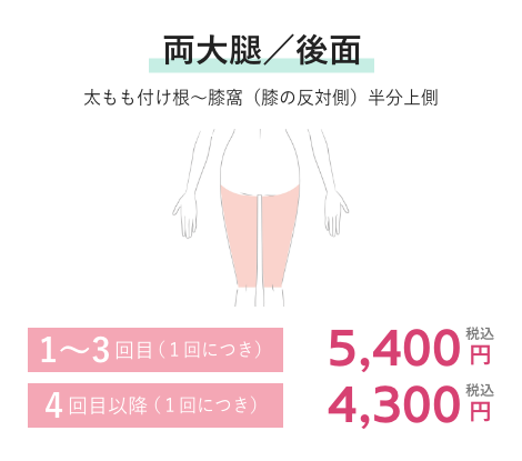 両大腿／後面 1~3回目(1回につき)5,400円税込 4回目以降(1回につき)4,300円税込