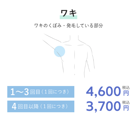 ワキ 1~3回目(1回につき)4,600円税込 4回目以降(1回につき)3,700円税込