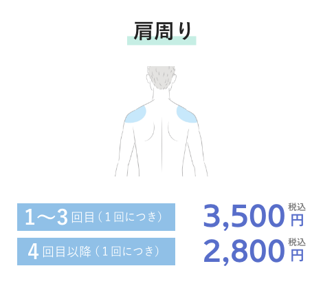 肩周り 1~3回目(1回につき)3,500円税込 4回目以降(1回につき)2,800円税込