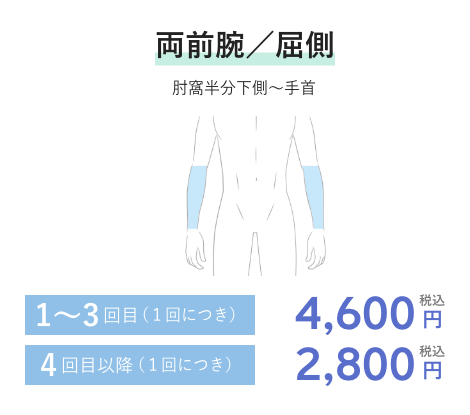 両前腕／屈側 1~3回目(1回につき)4,300円税込 4回目以降(1回につき)2,600円税込