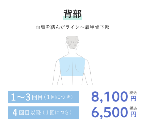 背部 1~3回目(1回につき)8,100円税込 4回目以降(1回につき)6,500円税込