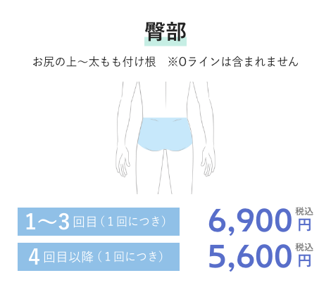 臀部 1~3回目(1回につき)6,900円税込 4回目以降(1回につき)5,600円税込