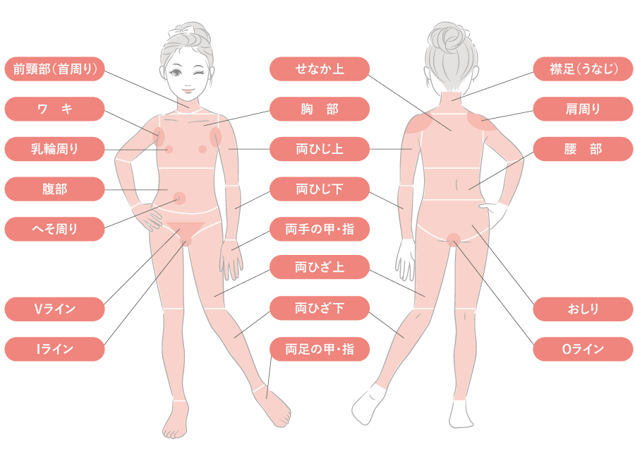医療脱毛(照射部位)