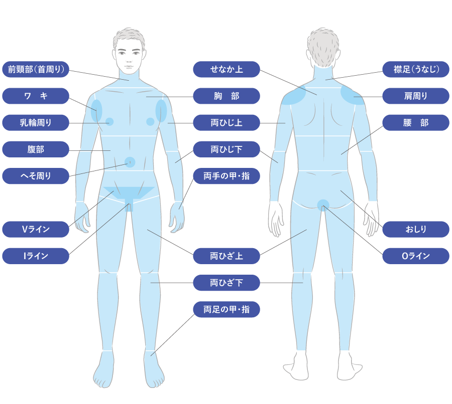医療脱毛(照射部位)